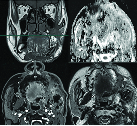 FIG 3.