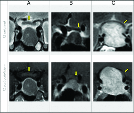 FIG 3.