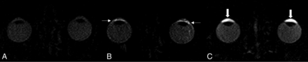 FIG 2.