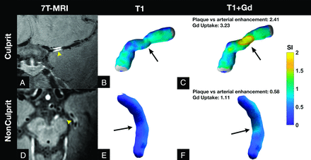 FIG 3.