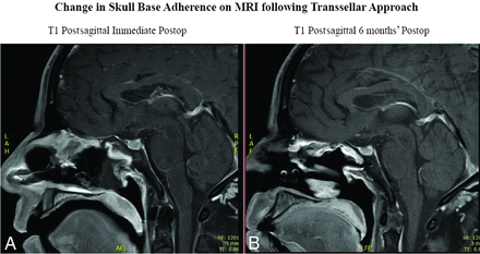 FIG 3.