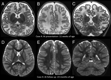FIG 1.