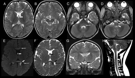 FIG 3.