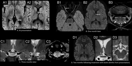 FIG 4.