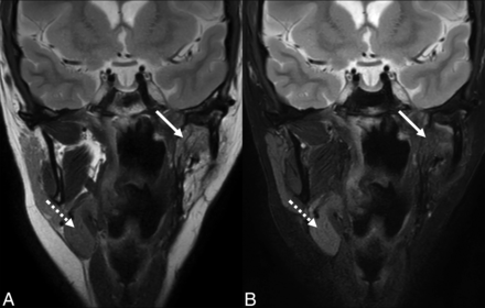 FIG 4.