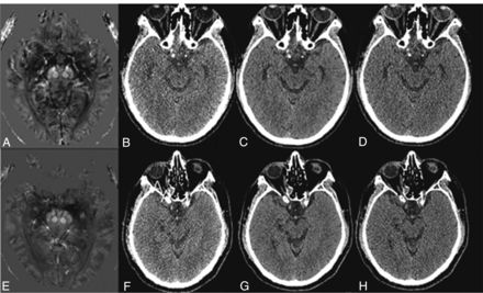 FIG 3.