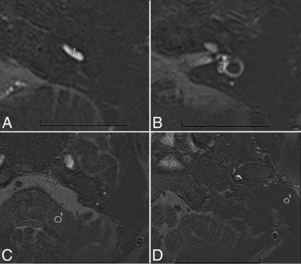 FIG 3.