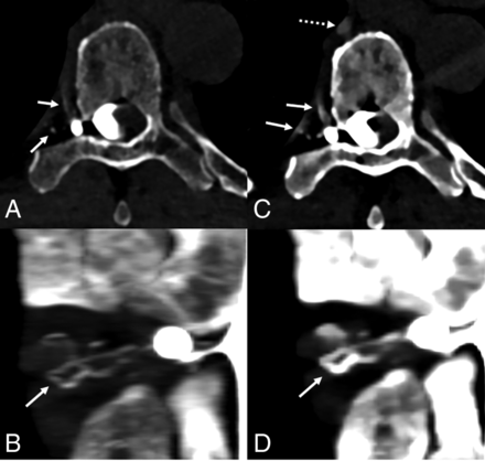 Fig 1.