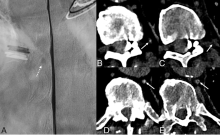 Fig 4.