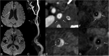 FIG 4.