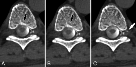 FIG 4.