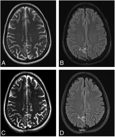 FIG 2.
