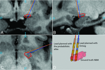 FIG 4.