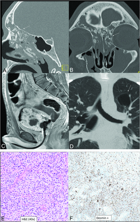 FIG 2.