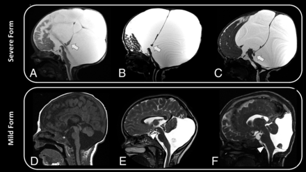 FIG 1.