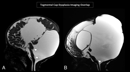 FIG 3.