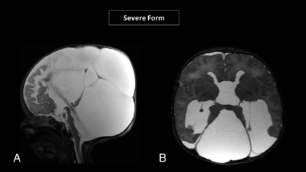 FIG 4.