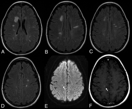 FIG 6.