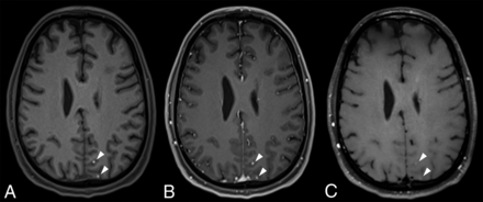 FIG 3.