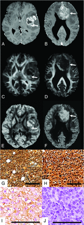 FIG 2.