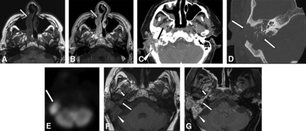FIG 3.