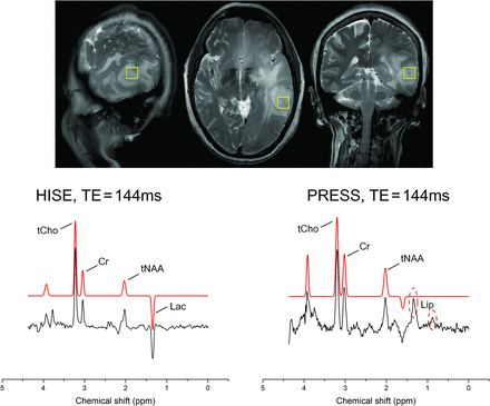 FIG 3.
