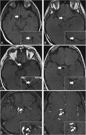 FIG 2.
