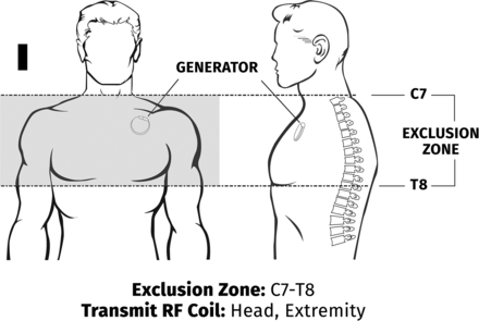 FIG 2.