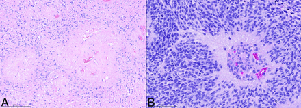 FIG 1.