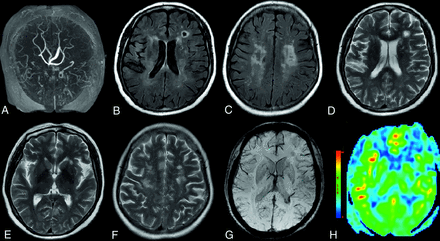 FIG 2.