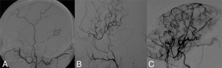 FIG 3.