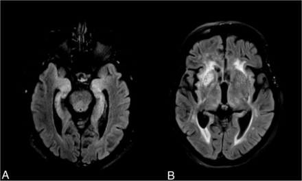 FIG 1.