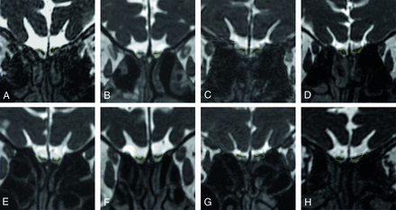 FIG 1.
