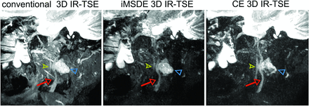 FIG 4.
