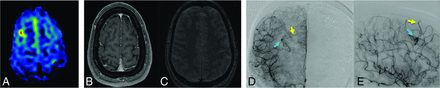 FIG 1.