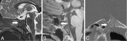 FIG 2.