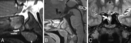 FIG 3.