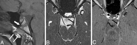 FIG 4.