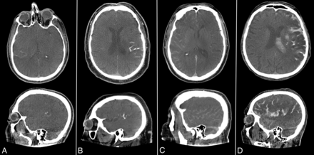 FIG 1.