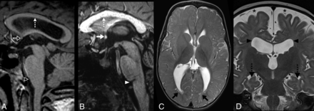 FIG 2.