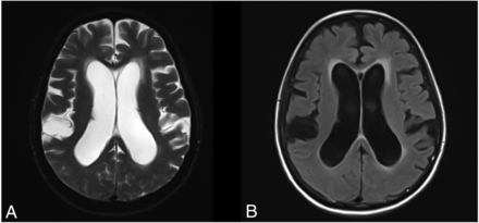 FIG 1.
