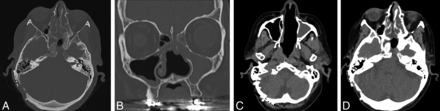FIG 3.