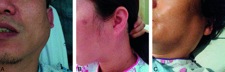 FIG 1.