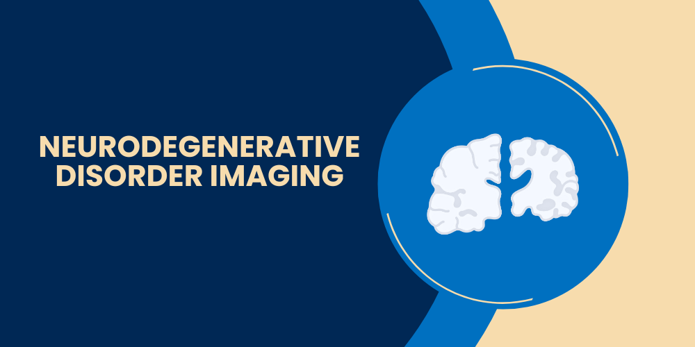 neurodegenerative_disorder_imaging.png