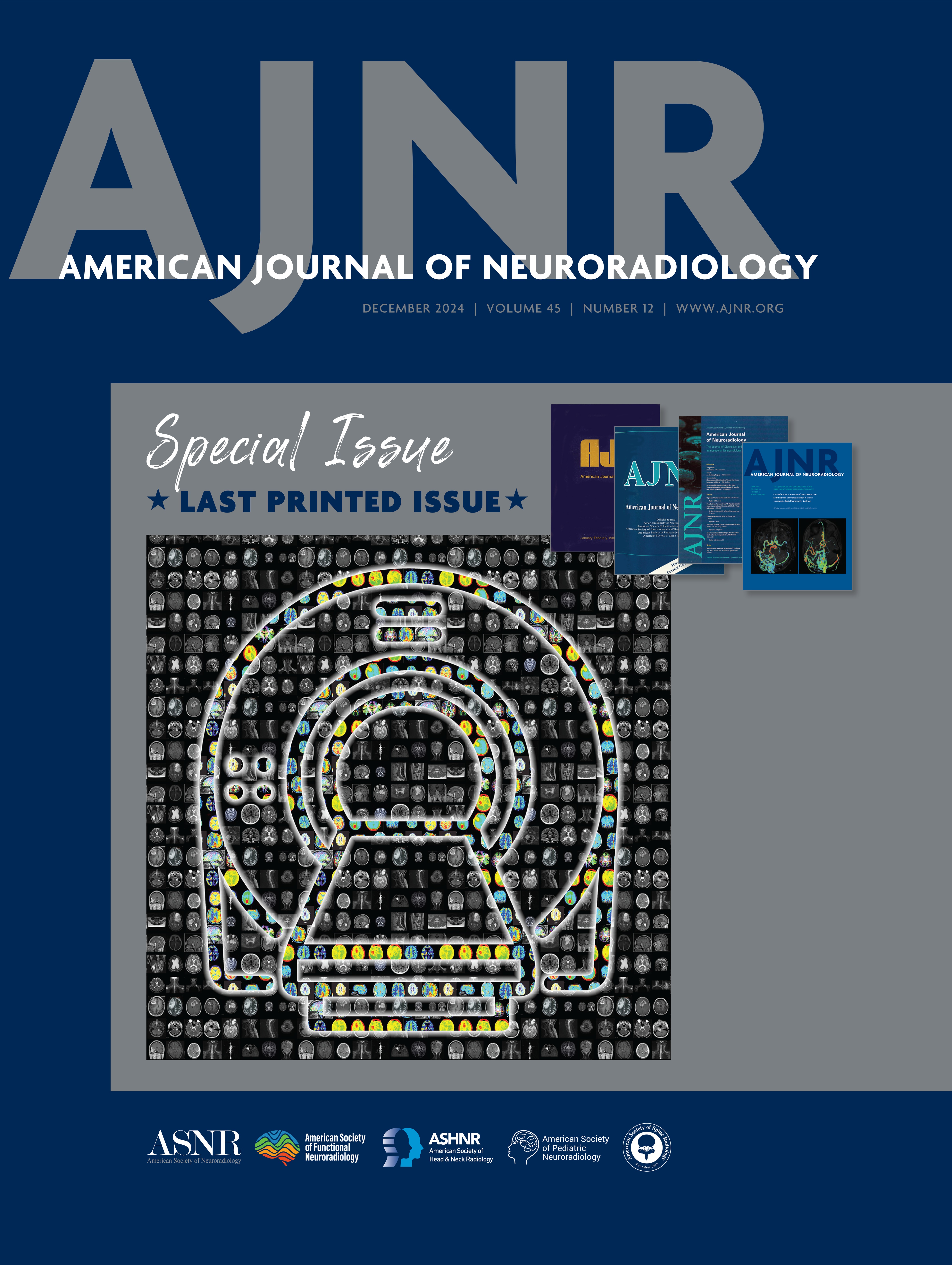 American Journal of Neuroradiology