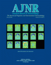 American Journal of Neuroradiology: 24 (2)