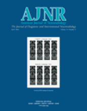 American Journal of Neuroradiology: 25 (4)