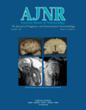 American Journal of Neuroradiology: 25 (6)