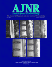 American Journal of Neuroradiology: 26 (5)
