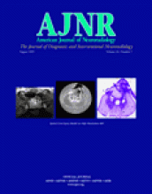 American Journal of Neuroradiology: 26 (7)